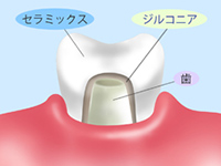 イメージ画像