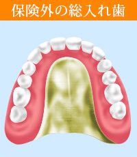 保険外の総入れ歯